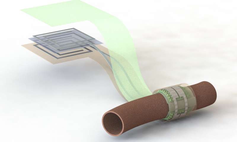 Stanford researchers create a wireless, battery-free, biodegradable blood flow sensor