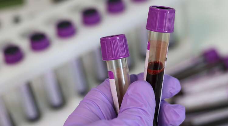 Startup to commercialize blood test for most major cancers