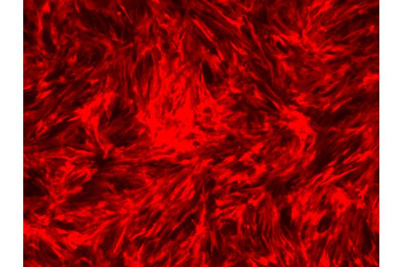 Stem cell scientists clear another hurdle in creating transplant arteries