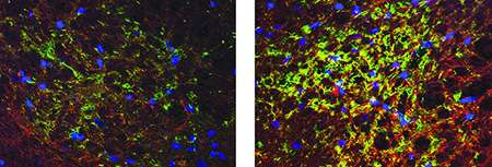Stroke drug boosts stem cell therapy for spinal cord injury in rats