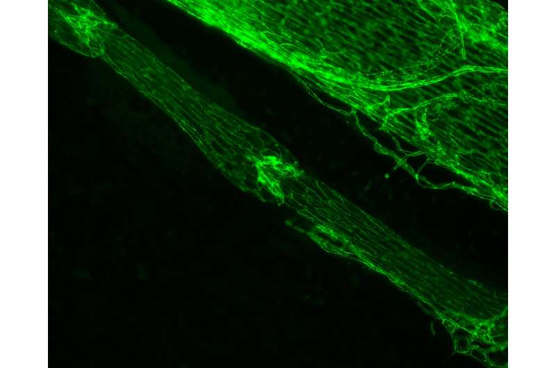 Study finds cellular processes controlling the formation of lymphatic valves