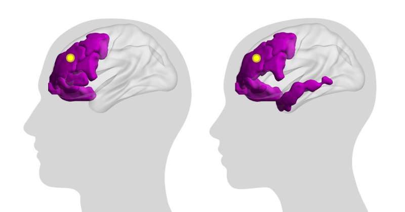 Study illuminates the brain's inner workings
