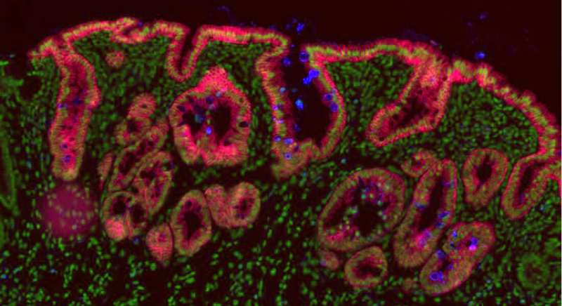 Surprising research result: All immature cells can develop into stem cells