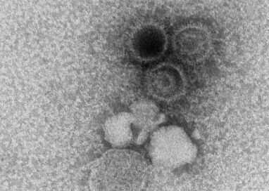 Tailored T-cell therapies neutralize viruses that threaten kids with PID