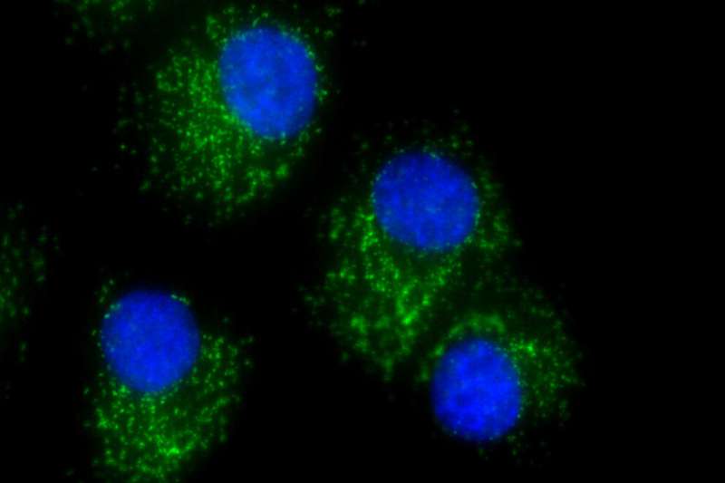 Targeting a key protein may keep ovarian cancer cells from spreading