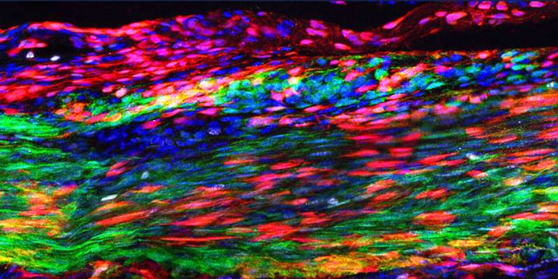 Tendon stem cells could revolutionize injury recovery