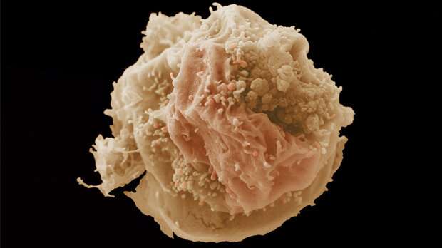 The breast cancer ‘avatar’ mice that could help personalise treatment 