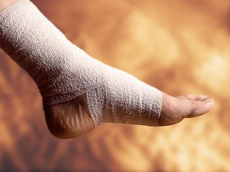 Topical wound oxygen therapy helps heal diabetic foot ulcers