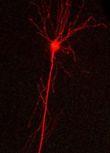 Tracking Alzheimer's disease pathology in single neuronal cells