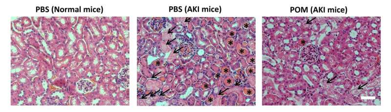 Ultrasmall nanoclusters and carbon quantum dots show promise for acute kidney injury