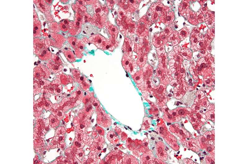 UMD discovers new mechanism in the liver that helps prevent invasive fungal infections
