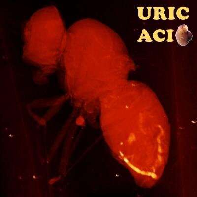 Uric acid pathologies shorten fly lifespan, highlighting need for screening in humans