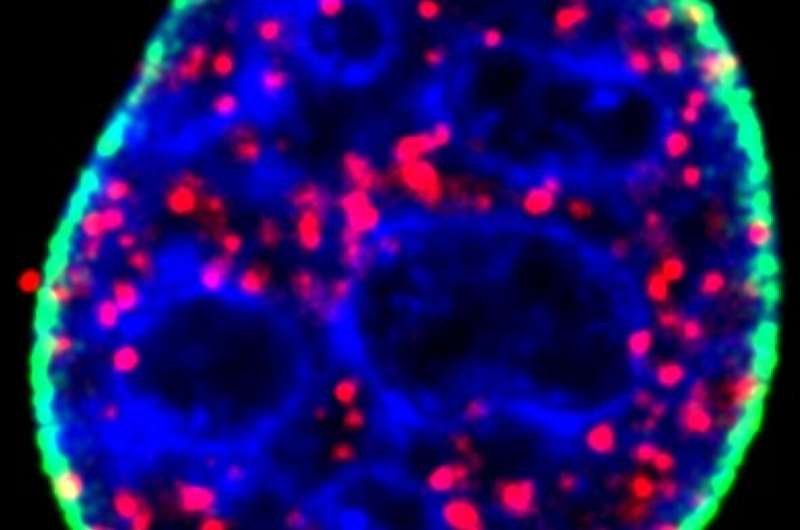 UW team finds key to common cancer pathway
