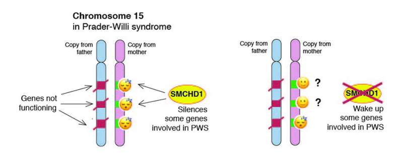 Waking "sleeping genes" could help Prader-Willi syndrome
