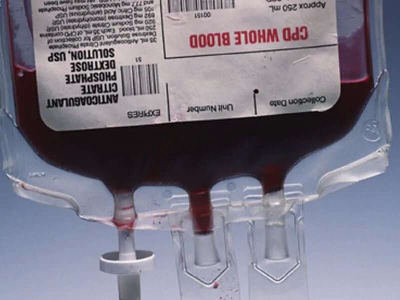 What if you were your own blood donor for surgery?