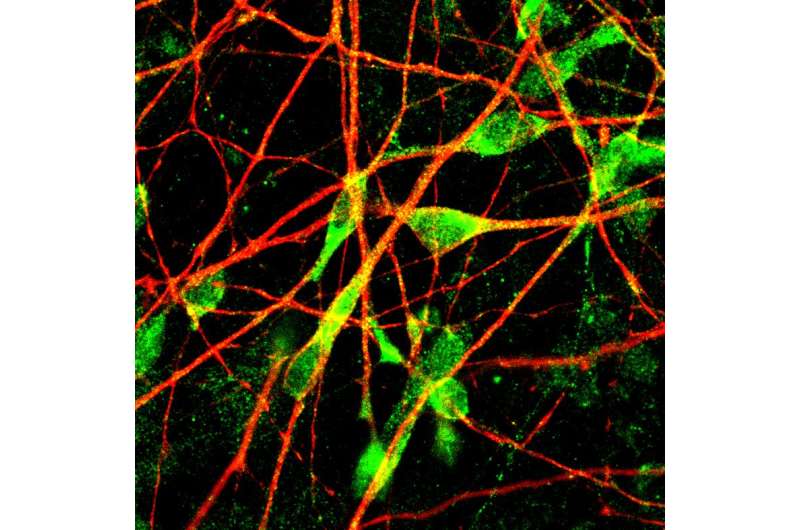When neurons are out of shape, antidepressants may not work