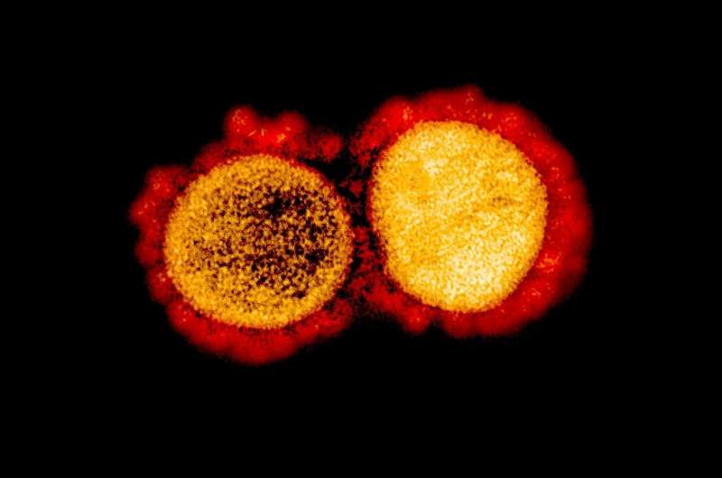 Aa transmission electron micrograph of SARS-CoV-2 virus particles, isolated from a patient,captured and color-enhanced