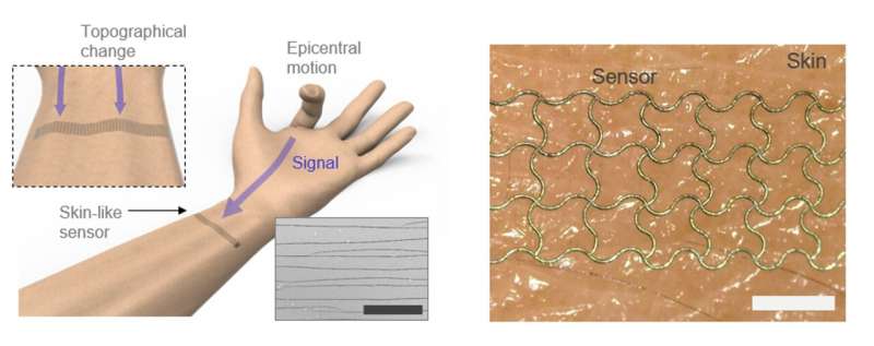 A deep learning-enhanced e-skin that can decode complex human motions