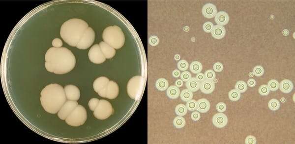 A new hybrid fungus is found in hospitals and linked to lung disease