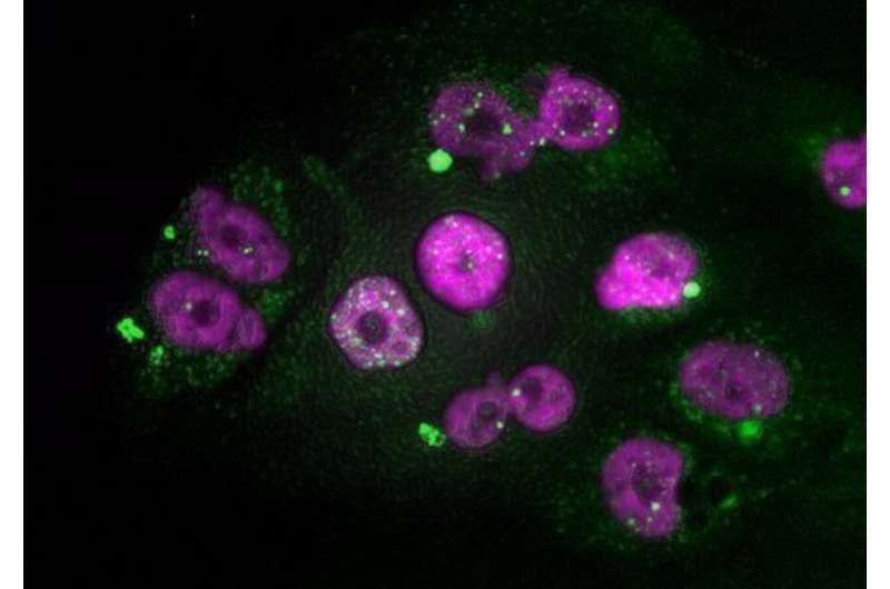 A new strategy to prevent the most aggressive tumors from generating resistance to chemotherapy