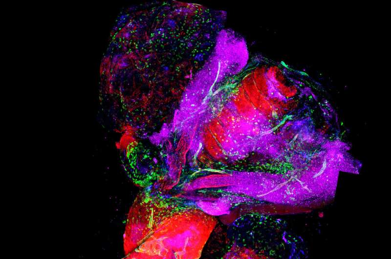 An international study discovers a new origin of lymphatic vessels in the heart
