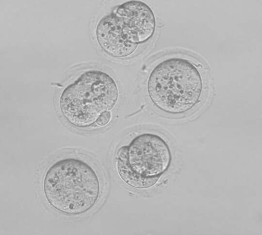 A novel sperm selection technology to increase success rates of in vitro fertilization