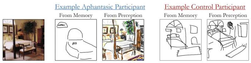 Can’t draw a mental picture? Aphantasia causes blind spots in the mind’s eye