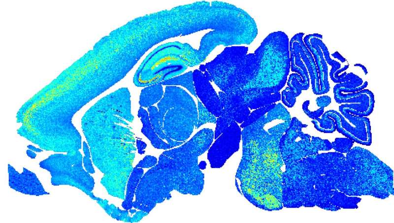 Clues to ageing come to light in vivid snapshots of brain cell links
