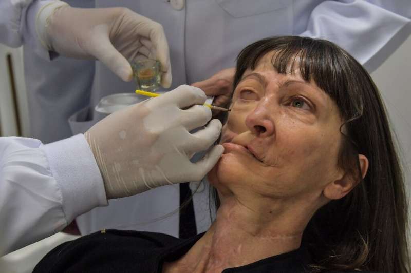 Denise Vicentin's journey to facial prosthetics began three decades ago when she developed a facial tumor