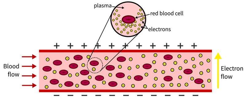 Engineer uses mechanical resistance to detect damage to red blood cells