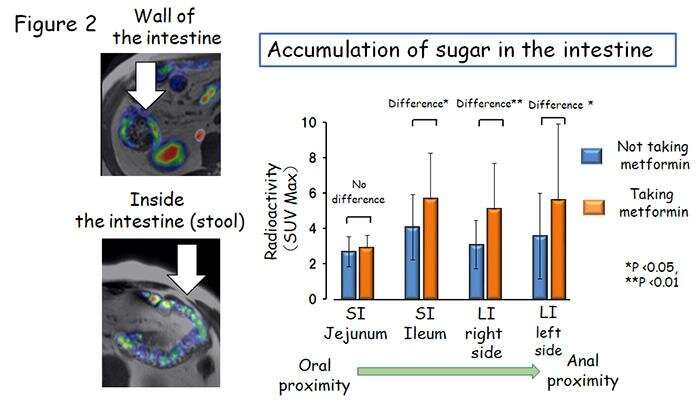 'Excretion of sugar into stool'? New action of anti-diabetic drug discovered
