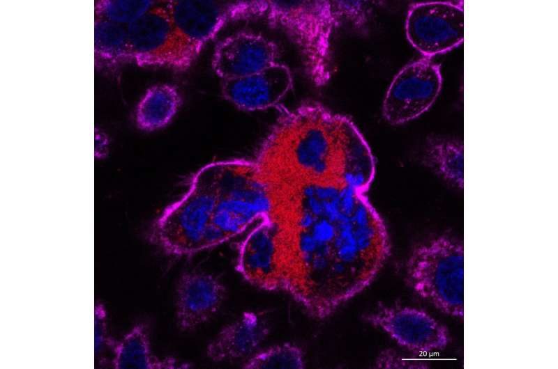 Host cell fusion in bacteria infection alarms immune system, causing host cell destruction