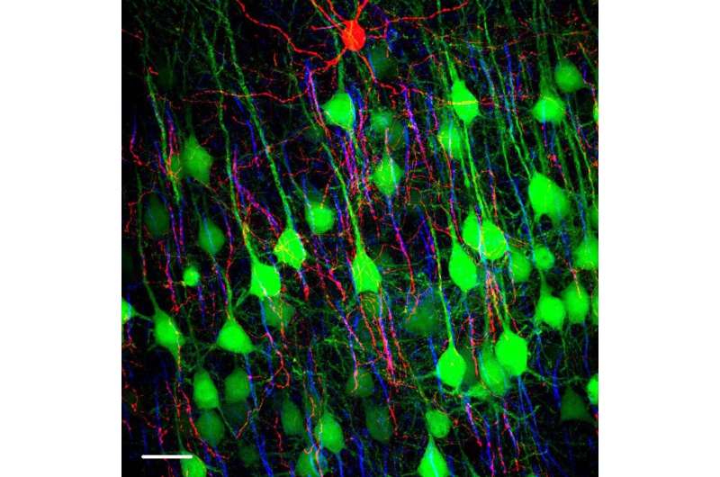 How chandelier cells light up the brain
