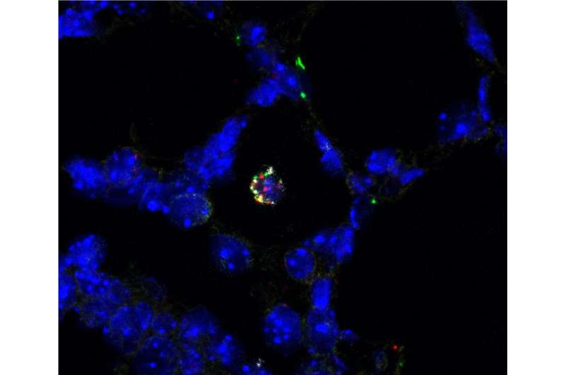 Immune cells multiply and diversify in mouse lungs at birth
