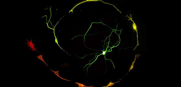 Jumping genes help make neurons in a dish