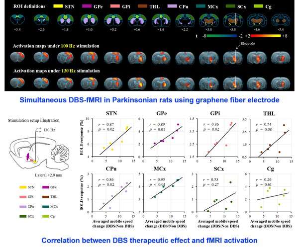 Key progress on the MRI compatible DBS electrodes and simultaneous DBS-fMRI