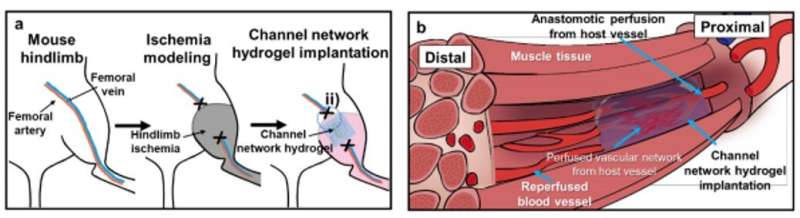Microchannel network hydrogel-induced ischemic blood perfusion connection