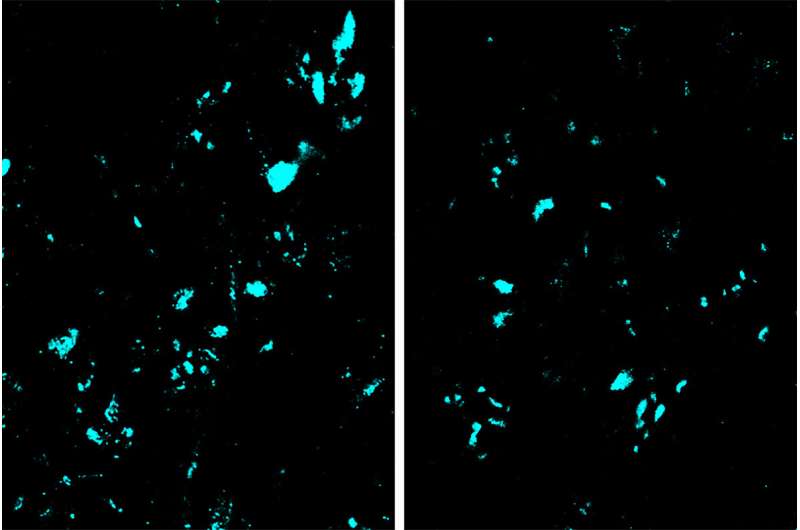 New CRISPR base-editing technology slows ALS progression in mice