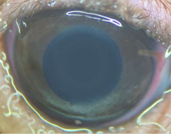 New method gives glaucoma researchers control over eye pressure
