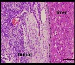 New model shows how cells that cause liver cancer are created