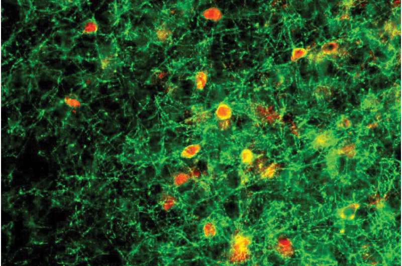 Research team investigates abnormal neuron activity in Rett syndrome
