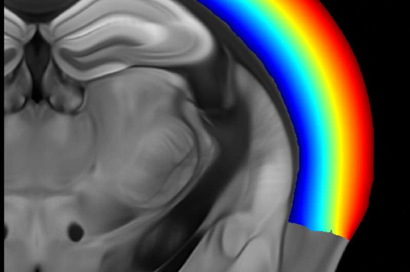 See a 3D mouse brain with single-cell resolution