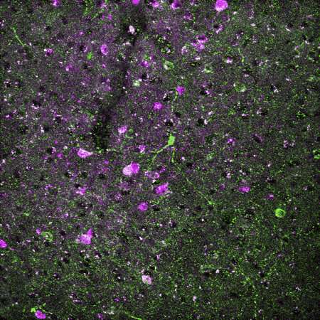 Some neurons target tiny cerebral blood vessel dilation