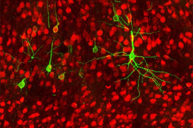 Study traces brain-to-gut connections