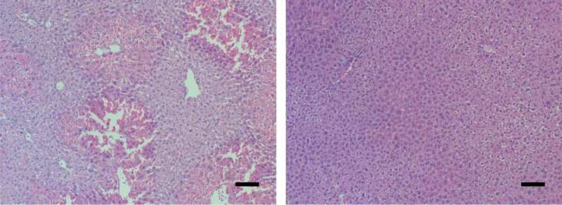 Surprising players in acute liver failure point to potential treatment
