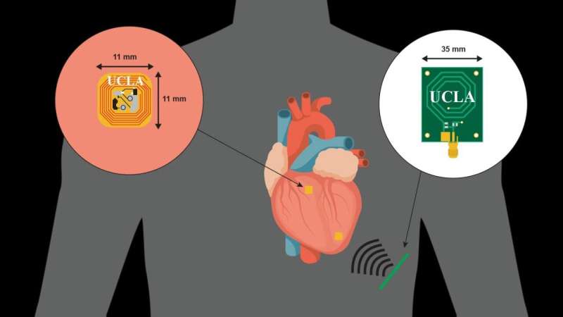 Texas Heart Institute and UCLA reveal innovative pacing system in Scientific Reports