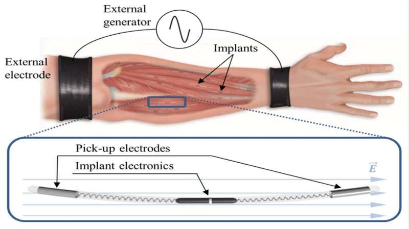 The human body as an electrical conductor, a new method of wireless power transfer