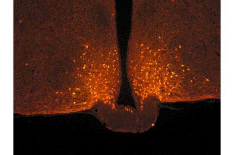 The origin of satiety: Brain cells that change shape after a meal