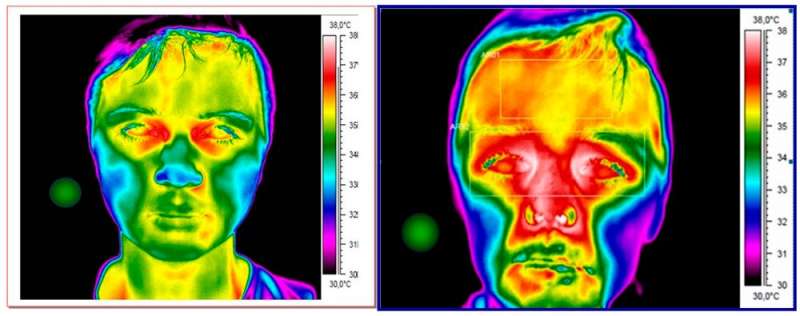 Thermal cameras aren't perfect, but they can help control the coronavirus pandemic