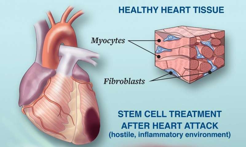 UC Davis researchers find a way to help stem cells work for the heart